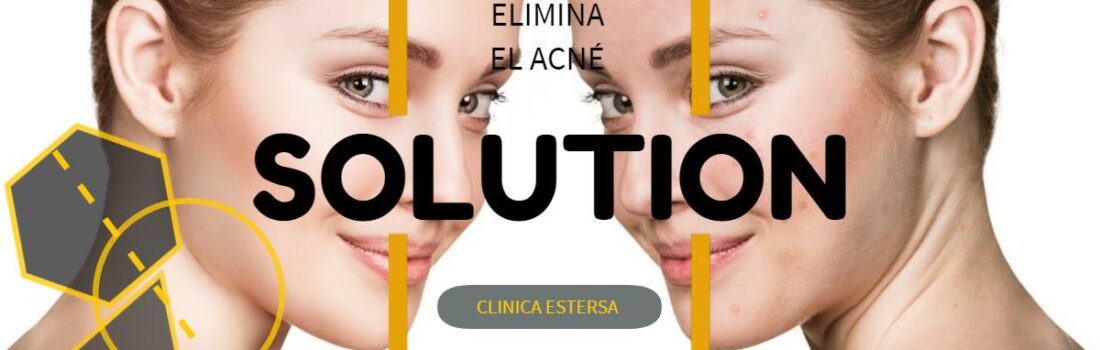 La solución para eliminar el acné la encuentras en la Clínica Médico Estética Estersa.